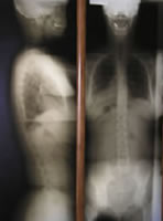 �����g�Q���ʐ^